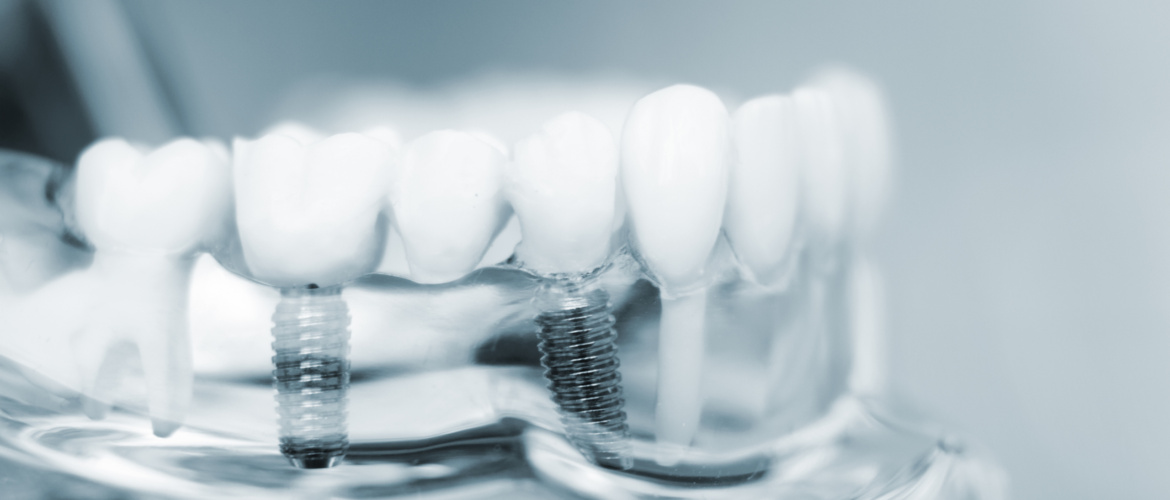 Spotlight on 3D Printing – An interview with Sales Director at CitoForma