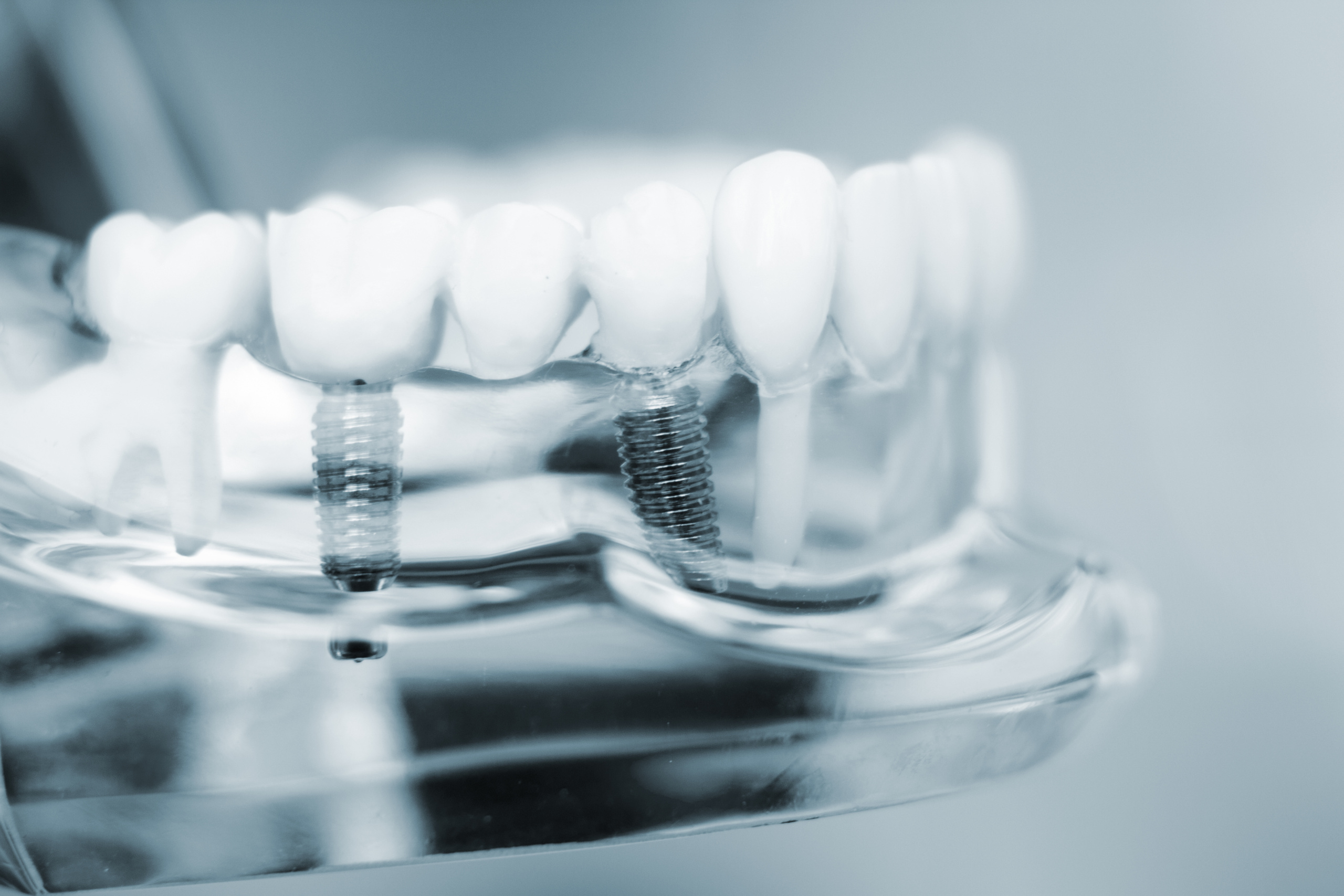 Spotlight on how 3D Printing is changing the face of dentistry with Todd Ames