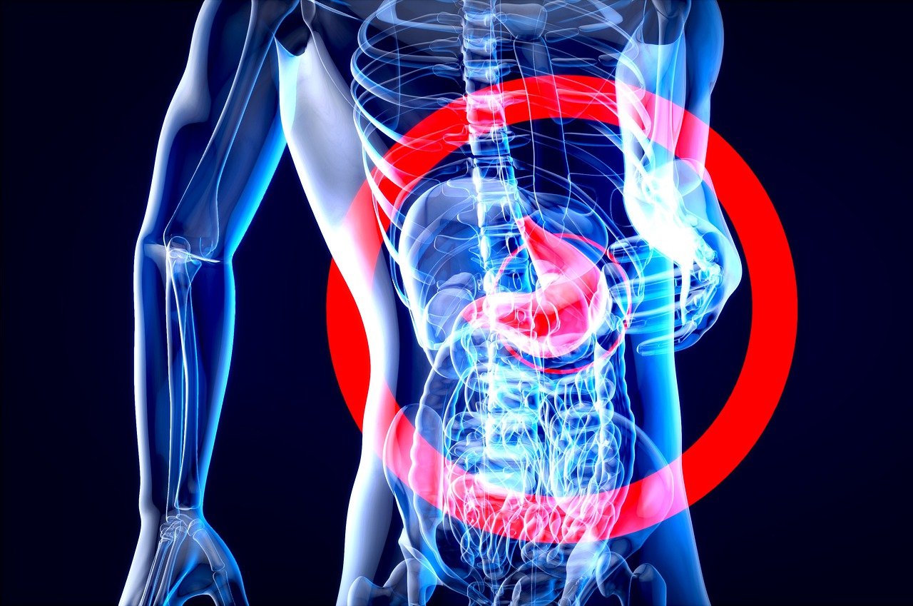 digestive health xray image