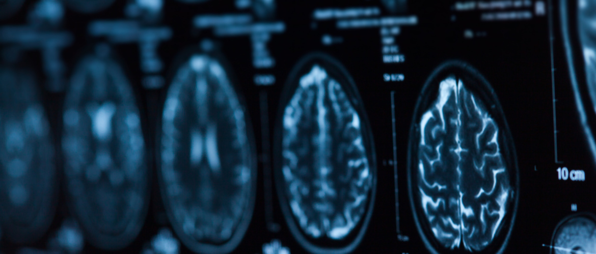 Spotlight On Neuronic: An Interview with Co-Founder Liam Pingree