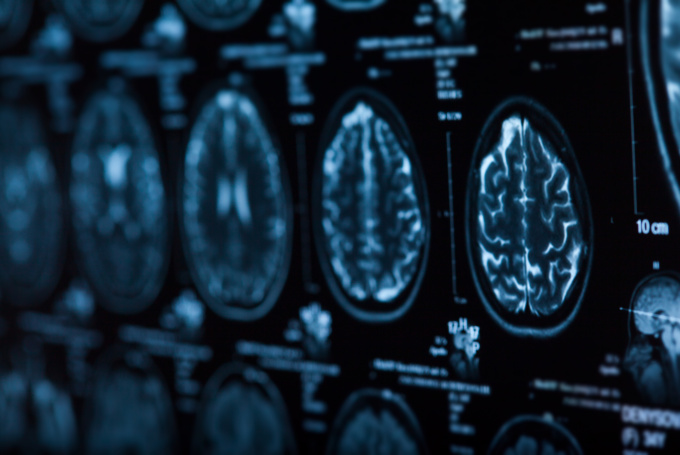 Spotlight On Neuronic: An Interview with Co-Founder Liam Pingree